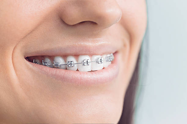 Best Dental Implants  in Maryville, TN